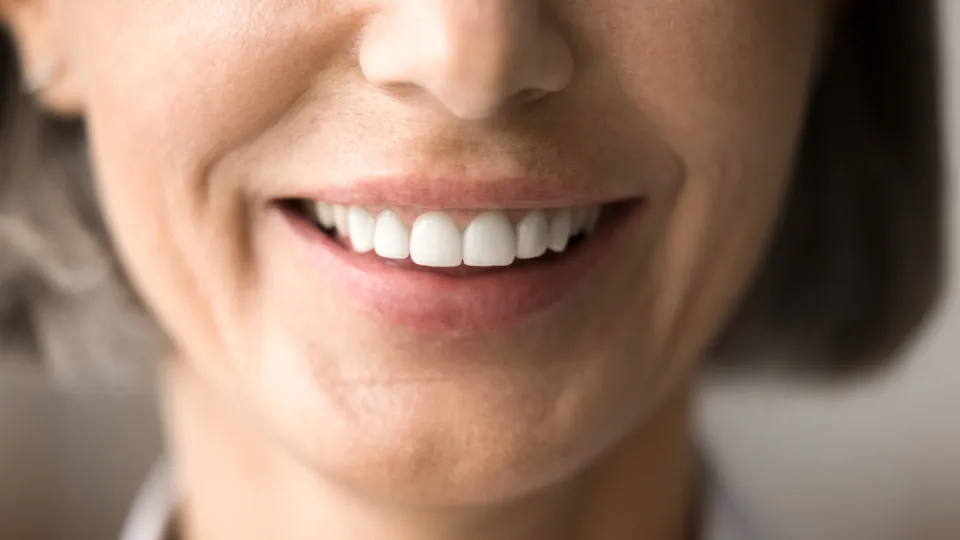 dentes