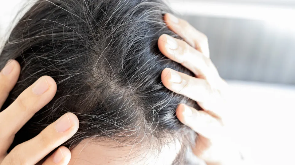 Cabelo branco